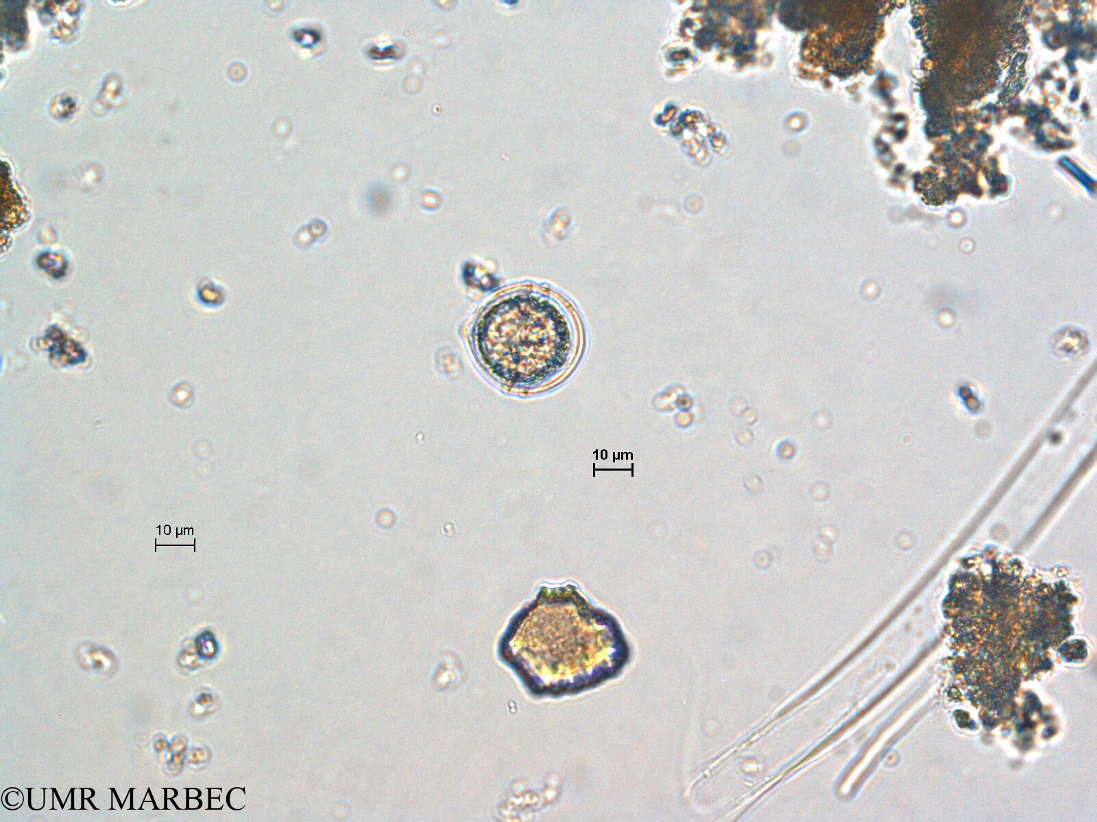 phyto/Scattered_Islands/europa/COMMA April 2011/Dino 9 (ancien Dino ae < Diplopsalopsis sp recomposé)(copy).jpg